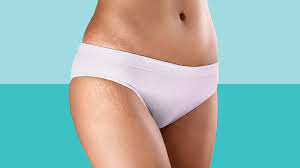What is Revamin Stretch Mark for?